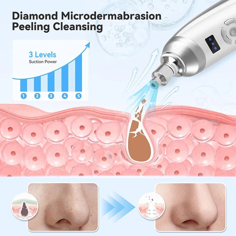 Diamond Microdermabrasion Machine – Professional Blackhead Remover & Deep Pore Cleansing Facial Tool